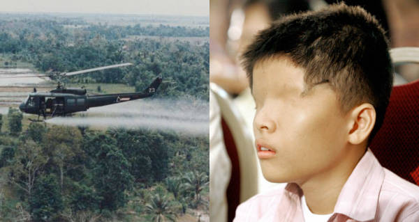 A Victim Of Made IN USA Agent Orange